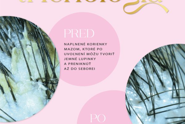 Trichológia 3 - GLAM - Naše práce